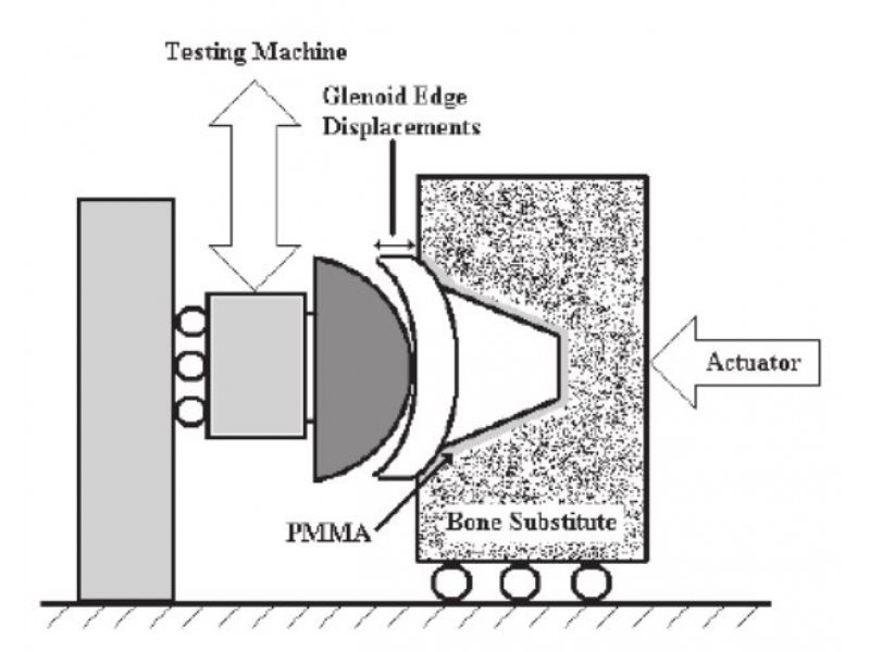 Shoulder Glenoid Loosening Testing ASTM F2028